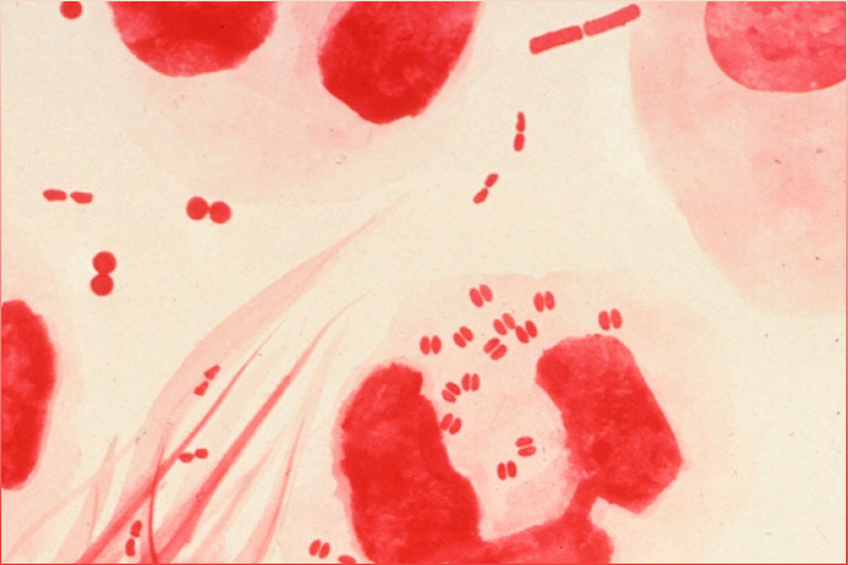 The FDA Approves At-Home Test for Chlamydia and Gonorrhea: A Game-Changer in STI Detection - -463238228